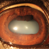 Iridology .jpg